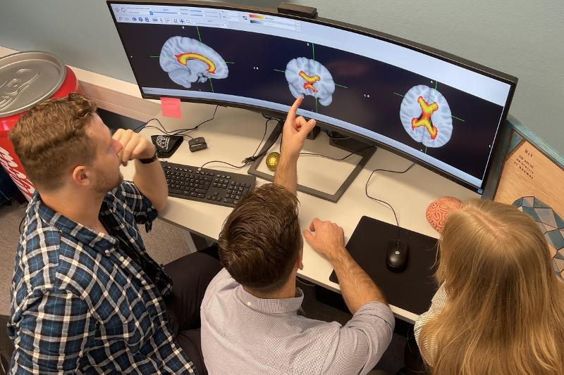To menn og ei kvinne ser på ein dataskjerm med datamodellar av ein hjerne. Den eine mannen peiker på skjermen. Biletet er tatt ovanfrå.